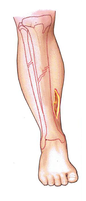 skin1